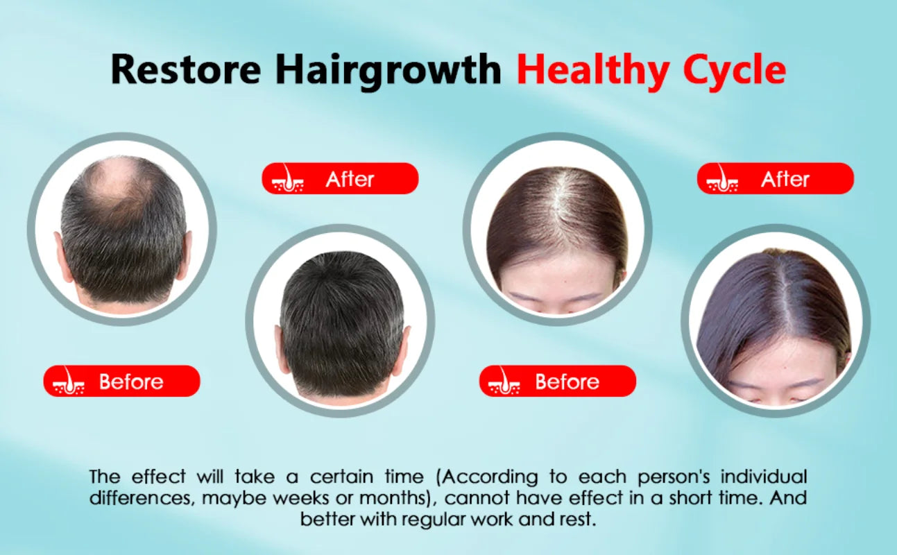 Hair Growth Cap - viphealths.com